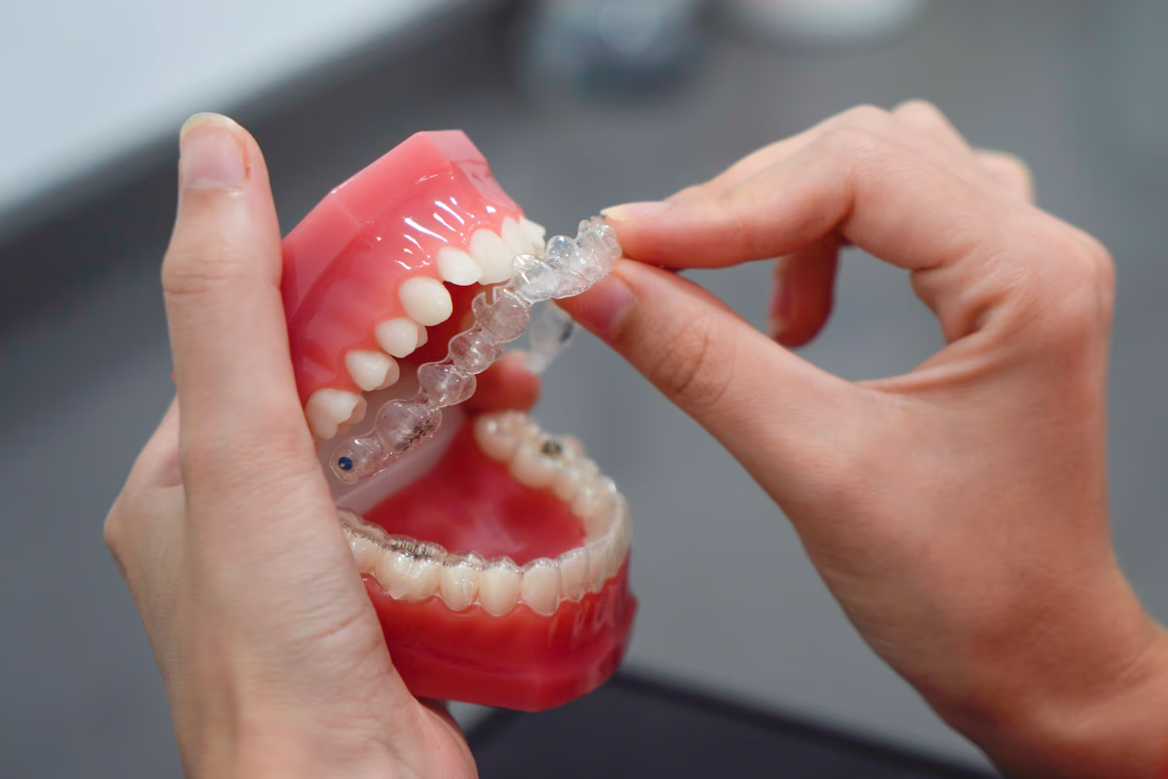 Illustration for blog post: The Clear Aligner Revolution Transforming Your Smile with Confidence