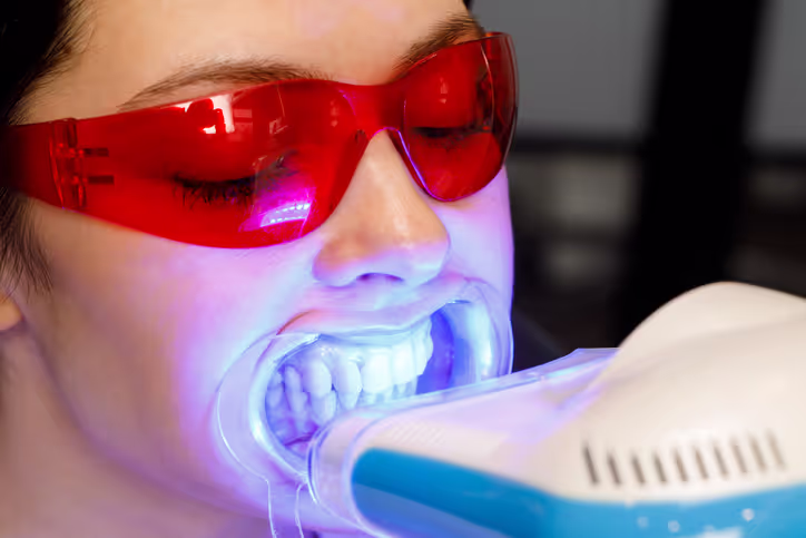 Zoom whitening
